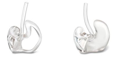 Consejos para cuidar el molde del audífono Consejos para cuidar el molde del audífono