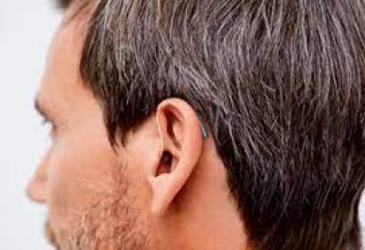 ¿Necesito audífonos para los acúfenos? ¿Necesito audífonos para los acúfenos?