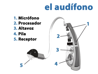 Qué es un audífono, ¿para qué sirve?